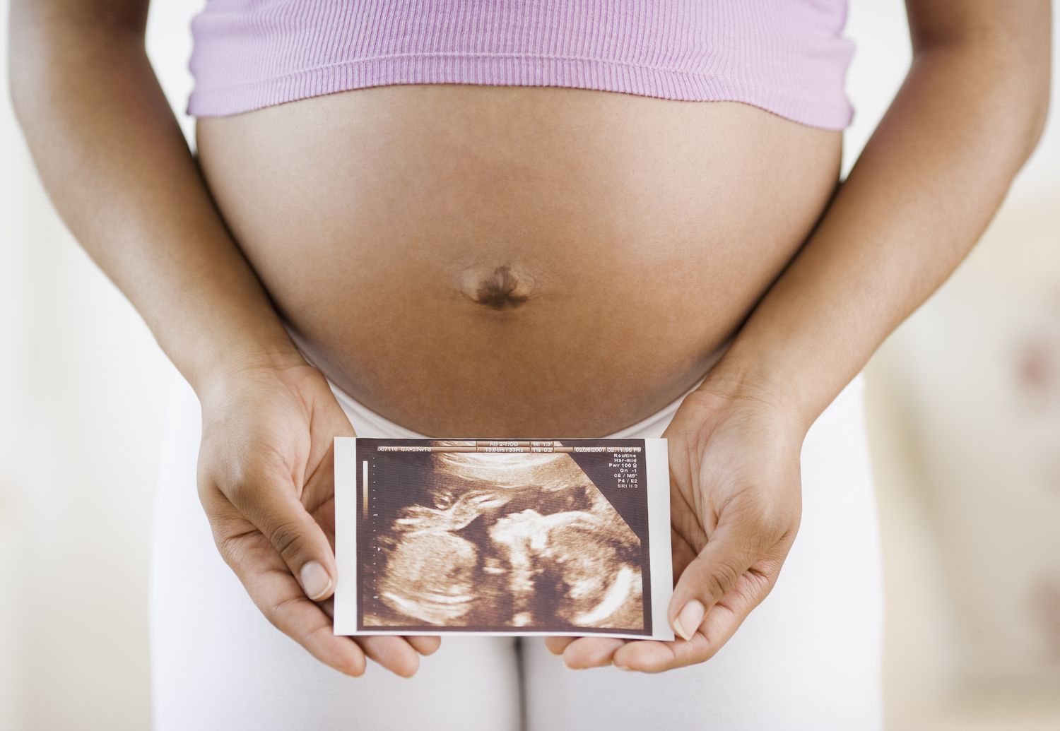 12 Week Ultrasound 3D Images Capturing your Amazing Pregnancy Movement