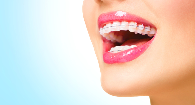 Orthodontic Treatment: Have A Great Smile